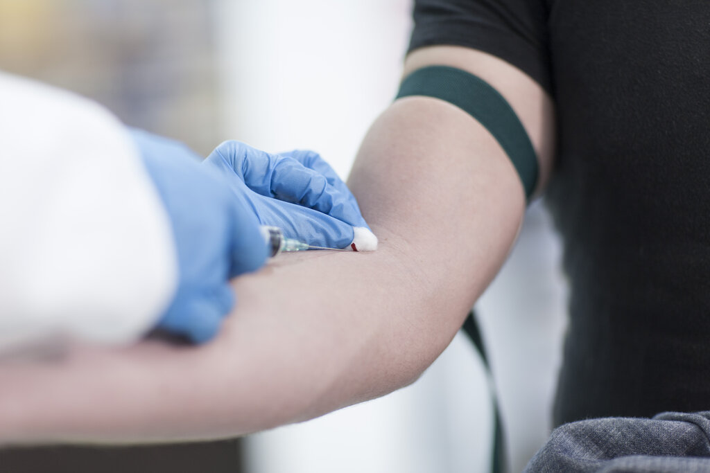 Eigenbluttherapie beim Heilpraktiker verboten? Die aktuelle Rechtslage